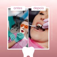 🦷 "Stop Scaring Off Patients With Ugly Posts"- 80+ High-Converting Canva Templates for Dental Clinics, Cosmetic Dentists & Orthodontists - Image 6