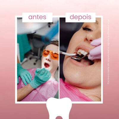🦷 "Stop Scaring Off Patients With Ugly Posts"- 80+ High-Converting Canva Templates for Dental Clinics, Cosmetic Dentists & Orthodontists - Image 6
